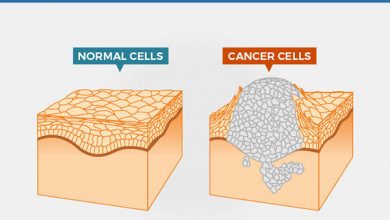ما هو السرطان ؟ 18 ما هو السرطان