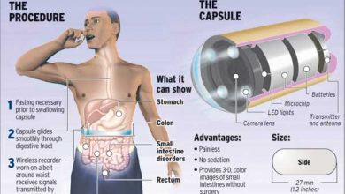 كبسولة المنظار , التنظير الكبسولي