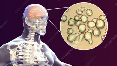 التهاب السحايا الفطري , التهاب السحايا بالفطور 