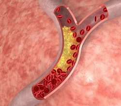 الدهون و الشحوم الثلاثية 19 اطعمة لحرق و تنزيل الدهون الثلاثية