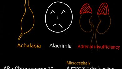 متلازمة aaa 16 متلازمة aaa