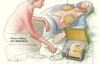 علاج توقف القلب 19 علاج توقف القلب