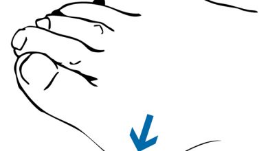 الوكعة, بروز عظمة إصبع القدم الكبير