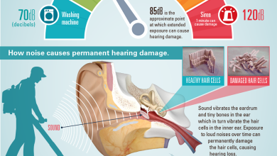 ضعف السمع بسبب الضجيج