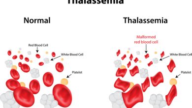 فحص تشخيص الثلاسيميا 20 فحص تشخيص الثلاسيميا