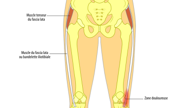 6 نصائح للحفاظ على صحة العظام