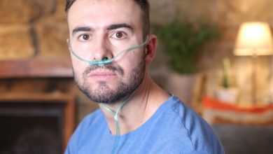 متلازمة ضيق النفس الحادة: 5 أسباب 19 متلازمة الضائقة التنفسية الحادة