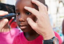 اسباب ضعف البصر الدماغي