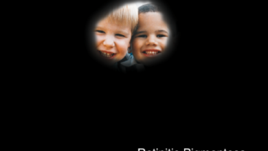 التهاب الشبكية الصباغي: 5 أعراض 18 كيف يرى التهاب الشبكية الصباغي