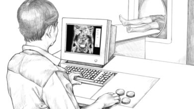 هل يظهر سرطان القولون في الاشعة المقطعية؟ 17 كشف سرطان القولون في الاشعة المقطعية؟