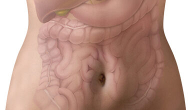 تصوير القولون بصبغة حقنة الباريوم: 10 حالات 21 تصوير القولون بصبغة حقنة الباريوم الملونة الظليلة