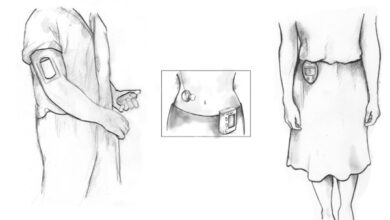 أجهزة المراقبة المستمرة للسكر