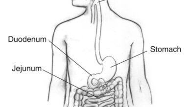 تهيج و تشنج الكولون عند الأطفال