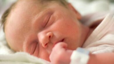 اعتلال الشبكية الخداجي: 5 مراحل 17 مراحل اعتلال الشبكية الخداجي