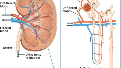 النفروز الكلوي عند الأطفال: 8 أعراض 16 أعراض النفروز الكلوي عند الأطفال