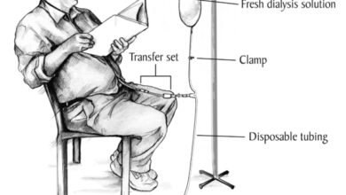 مضاعفات غسيل الكلى البريتوني