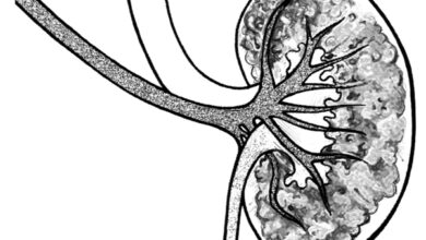 أعراض الكلى الاسفنجية