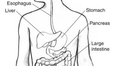 أعراض انسداد الأمعاء والقولون الكاذب
