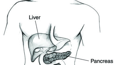 مرض هيموكروماتوز: 5 أعراض 18 مرض هيموكروماتوسيس