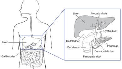 أعراض التهاب الأقنية الصفراوية المصلب الأولي