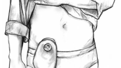 سبب فغر القولون والامعاء