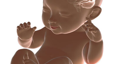 لماذا راس الطفل كبير؟ 18 لماذا يبدو راس الطفل كبير؟