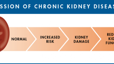 مرض برجير في الكلى: 8 معلومات 20 أعراض مرض برجير في الكلى