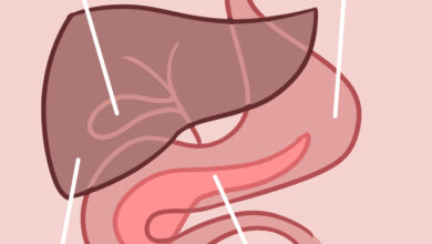 التهاب البنكرياس الحاد: 8 أعراض 16 اعراض التهاب البنكرياس الحاد