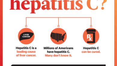 10 هي أعراض التهاب الكبد الوبائي c 16 اعراض التهاب الكبد c