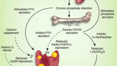 حثل العظام في الفشل الكلوي