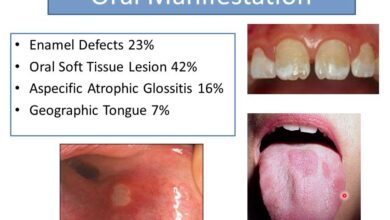هل حساسية القمح تؤثر على مينا الاسنان؟