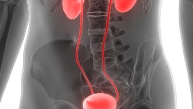 سبب وجود دم في البول