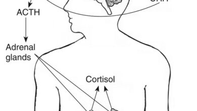 مرض اديسون: 9 أعراض 16 داء اديسون