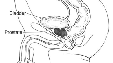 أنواع فحوص وتحاليل البروستات