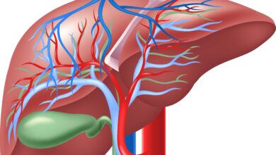 السمنة والريجيم وحصى المرارة: 3 حقائق 15 السمنة والريجيم وحصى المرارة