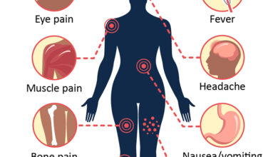 حمى الضنك: 4 أعراض 16 مرض فيروس حمى الضنك