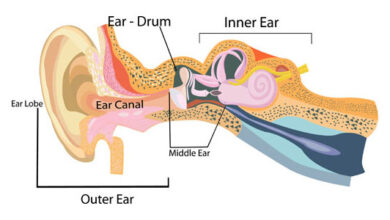 شوانوما العصب السمعي: 5 أعراض 20 اعتلال العصب السمعي