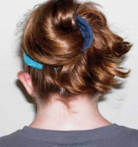 تناذر تيرنر