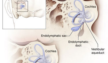 اسباب متلازمة بندرد