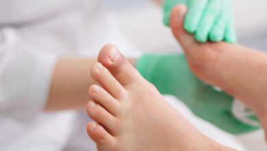 مرض النقرس: 8 أسباب 19 أسباب مرض النقرس