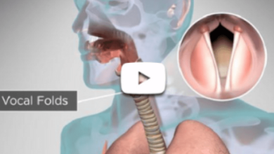 سبب الورم الحليمي في الحنجرة