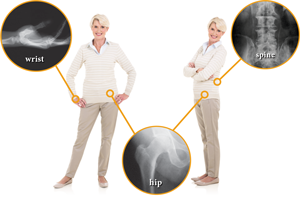 اماكن الكسور