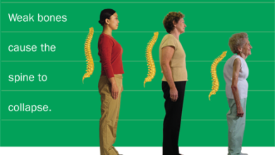 3 نصائح لتقوية العظام 17 نصائح لتقوية العظام