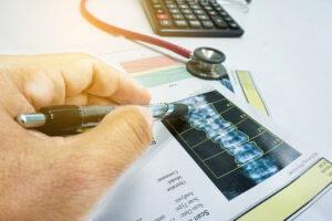 هشاشة العظام عند الرجال: 7 أسباب 14 نتيجة تصوير هشاشة العظام