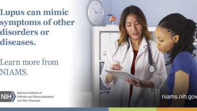 14 هي علامات الذئبة الحمامية الجهازية 20 اعراض الذئبة الحمامية الجهازية