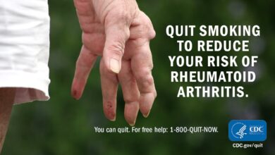 مرض الروماتويد: 6 أعراض 25 أسباب مرض الروماتويد