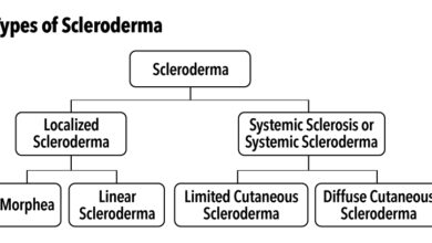 مرض صلابة الجلد: 6 أعراض 19 أنواع صلابة الجلد