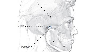 التهاب ومشاكل المفصل الفكي الصدغي