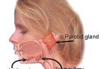 أمراض الغدد اللعابية: 8 أعراض 18 أمراض الغدد اللعابية