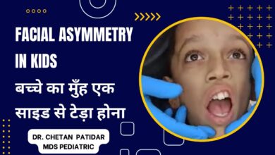 صغر نصف الوجه: 6 نصائح 22 صغر نصف الوجه